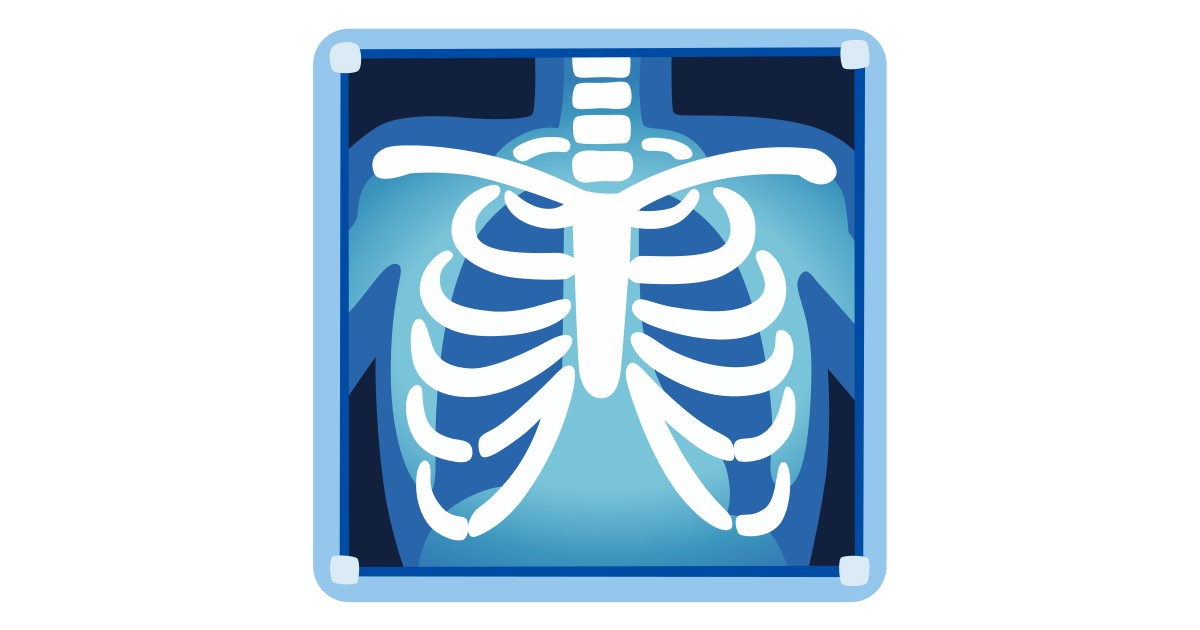 Смайлик рентген. Эмодзи рентген. Смайлик рентген. Фигурка рентгенолога. Рентгенография грудной клетки картина на белом фоне.